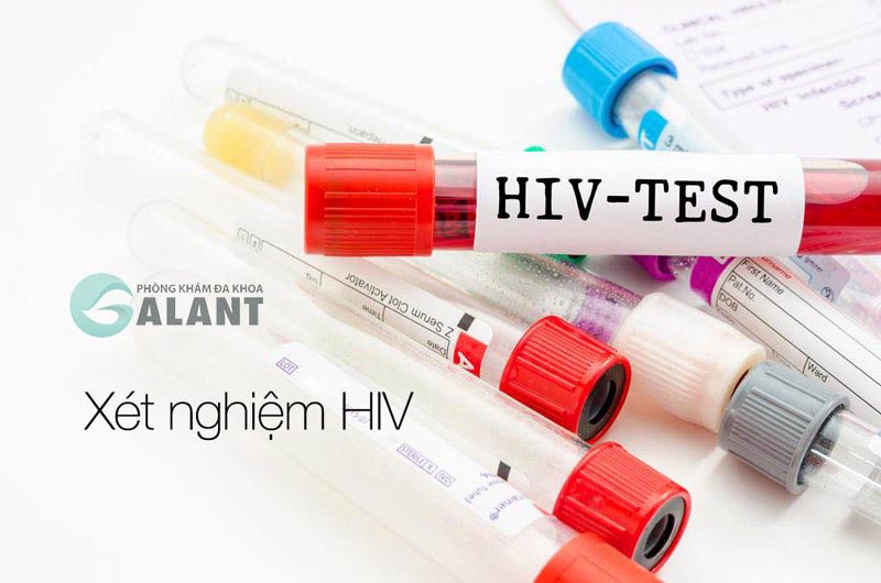 Rất Hay Test nhanh HIV Determine có chính xác không Galant Clinic