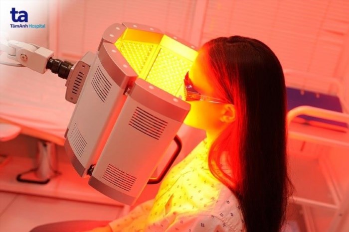 Công nghệ ánh sáng có thể được sử dụng để điều trị mụn mà không cần sử dụng bất kỳ loại thuốc nào, đây là một phương pháp an toàn.