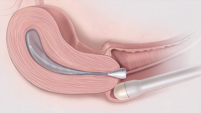 Siêu âm đầu dò âm hộ giúp các bác sĩ quan sát một cách rõ ràng các cơ quan sinh dục ở bên trong.