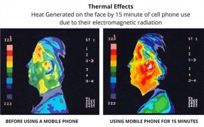 Sau khi sử dụng điện thoại quá độ, não bộ trở nên bất thường.