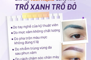 Cách xử lý lông mày trổ xanh trổ đỏ