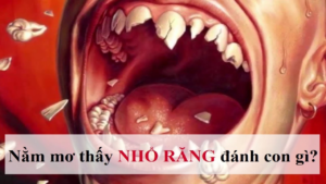 Nằm mơ thấy đi bác sĩ nhổ răng