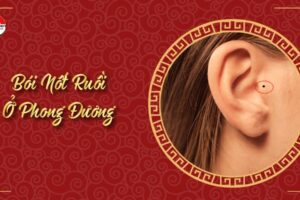 Nốt ruồi ở phong đương nữ