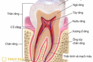 Răng sâu nhẹ nên làm gì
